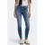 ONLY Onlblush Mid Sk Ank Rw Dnm Dot622 Noos jeans – mediumblauw
