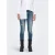 Only Skinny fit jeans ONLBLUSH MID SKIN ANK RW DNM REA593 NOOS